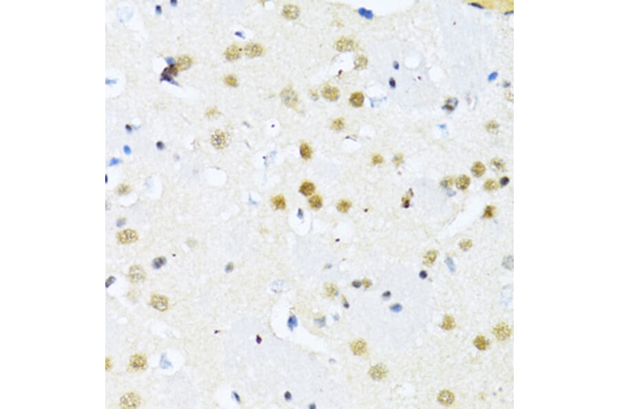 Immunohistochemistry - Anti-ITGB3BP Antibody (A91907) - Antibodies.com