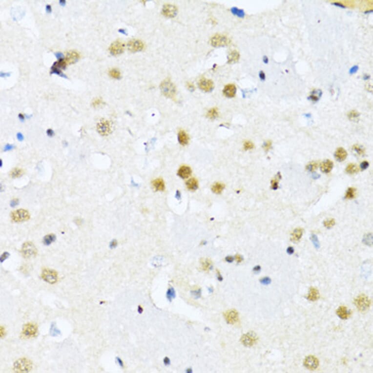 Immunohistochemistry - Anti-ITGB3BP Antibody (A91907) - Antibodies.com