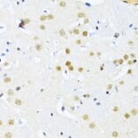 Immunohistochemistry - Anti-ITGB3BP Antibody (A91907) - Antibodies.com