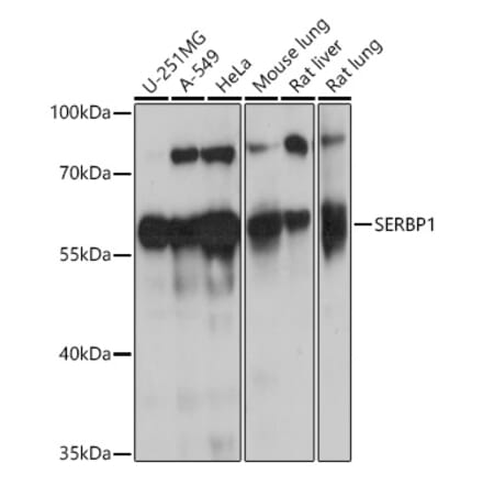 Western Blot - Anti-SERBP1 Antibody (A91908) - Antibodies.com