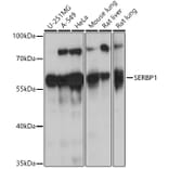 Western Blot - Anti-SERBP1 Antibody (A91908) - Antibodies.com