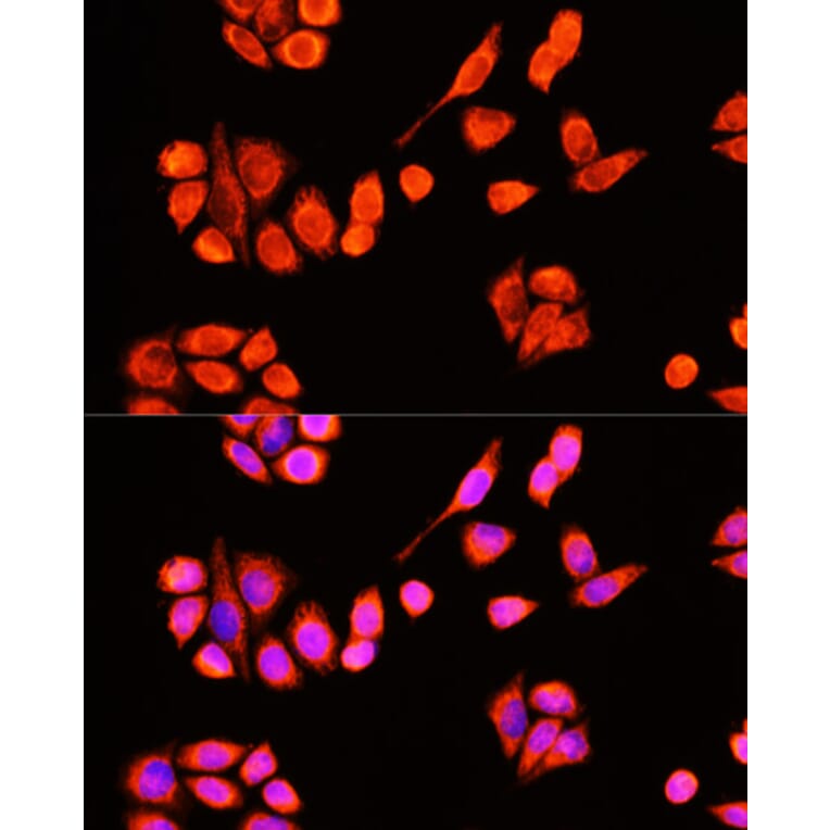 Immunofluorescence - Anti-DNAJC19 Antibody (A91909) - Antibodies.com