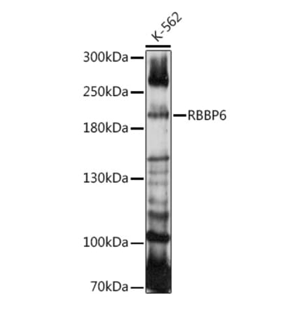 Western Blot - Anti-Retinoblastoma binding protein 6 Antibody (A91910) - Antibodies.com