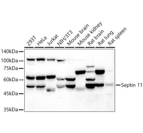 Western Blot - Anti-Septin 11 Antibody (A91914) - Antibodies.com