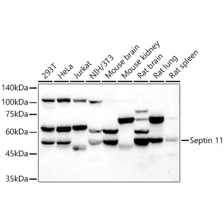 Western Blot - Anti-Septin 11 Antibody (A91914) - Antibodies.com