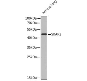 Western Blot - Anti-SKAP2 Antibody (A91915) - Antibodies.com