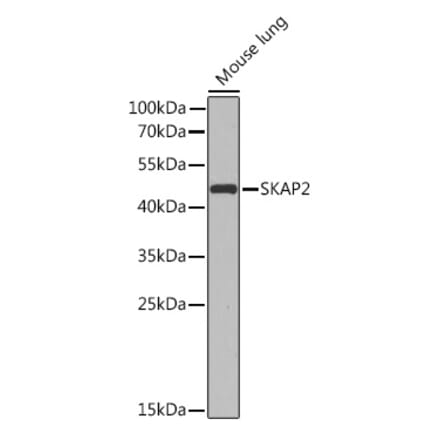 Western Blot - Anti-SKAP2 Antibody (A91915) - Antibodies.com