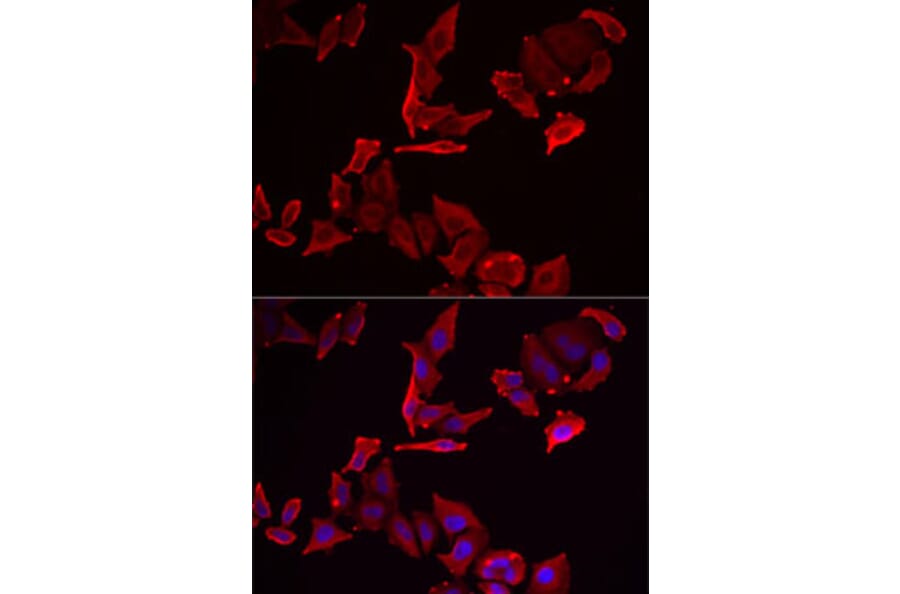 Immunofluorescence - Anti-SKAP2 Antibody (A91915) - Antibodies.com