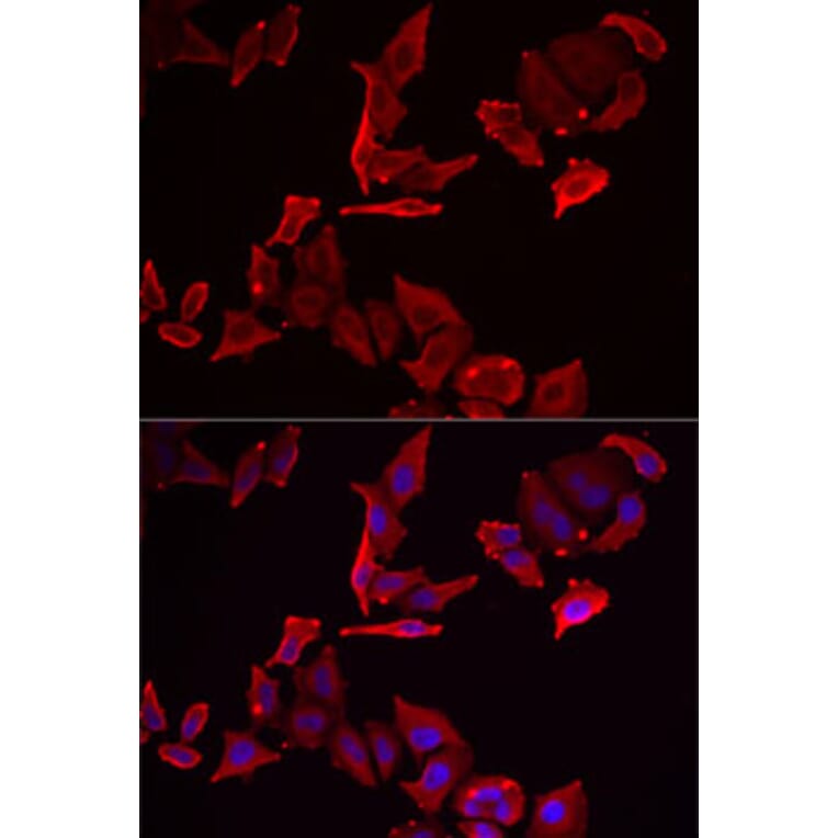 Immunofluorescence - Anti-SKAP2 Antibody (A91915) - Antibodies.com