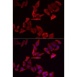 Immunofluorescence - Anti-SKAP2 Antibody (A91915) - Antibodies.com