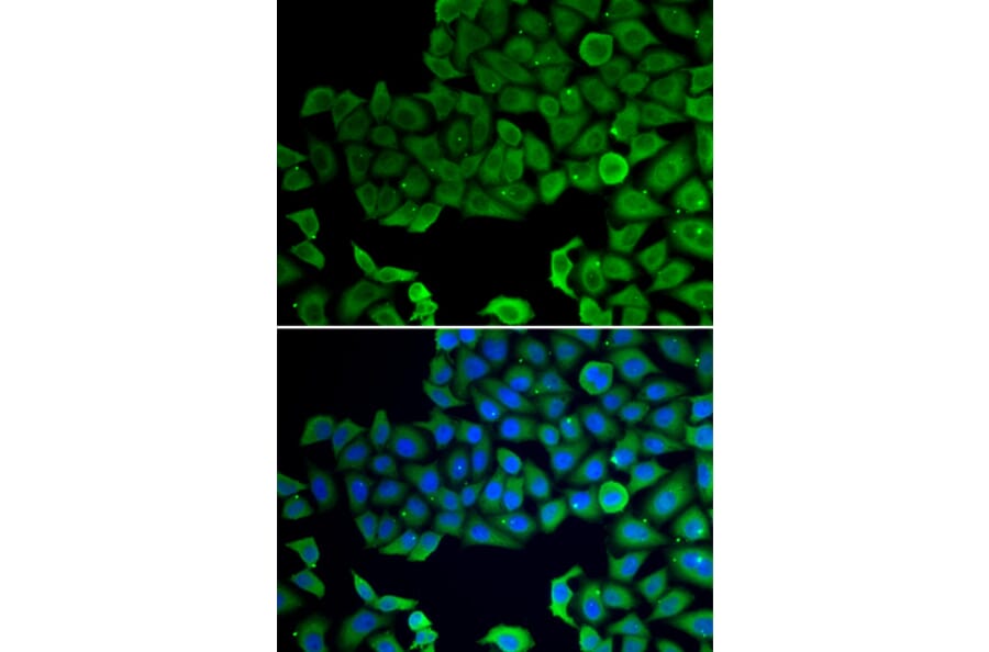 Immunofluorescence - Anti-VPS4A Antibody (A13416) - Antibodies.com
