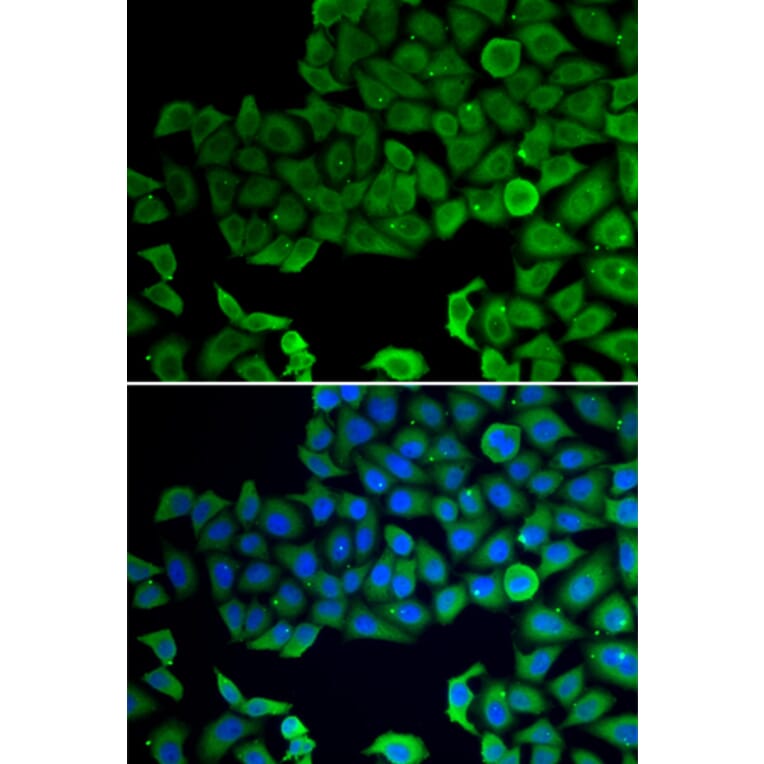 Immunofluorescence - Anti-VPS4A Antibody (A13416) - Antibodies.com