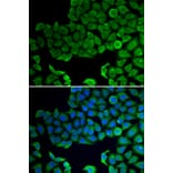 Immunofluorescence - Anti-VPS4A Antibody (A13416) - Antibodies.com