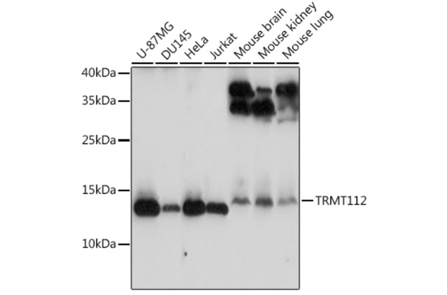 Western Blot - Anti-HSPC152 Antibody (A91918) - Antibodies.com