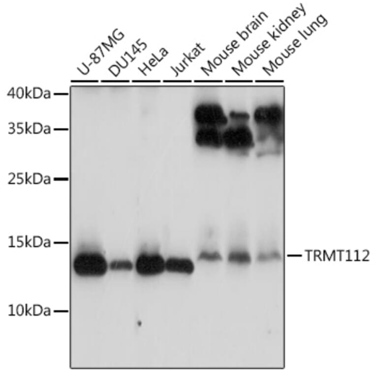 Western Blot - Anti-HSPC152 Antibody (A91918) - Antibodies.com