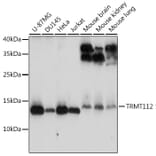 Western Blot - Anti-HSPC152 Antibody (A91918) - Antibodies.com