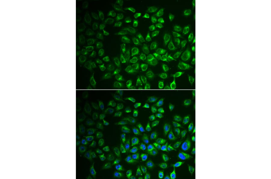 Immunofluorescence - Anti-FABP6 Antibody (A91920) - Antibodies.com