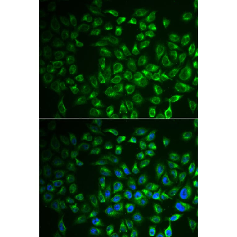 Immunofluorescence - Anti-FABP6 Antibody (A91920) - Antibodies.com