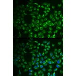 Immunofluorescence - Anti-FABP6 Antibody (A91920) - Antibodies.com