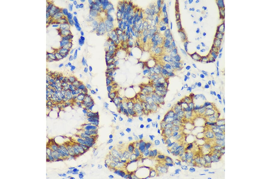 Immunohistochemistry - Anti-USP47 Antibody (A91921) - Antibodies.com