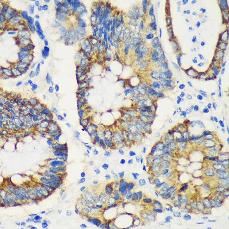 Immunohistochemistry - Anti-USP47 Antibody (A91921) - Antibodies.com