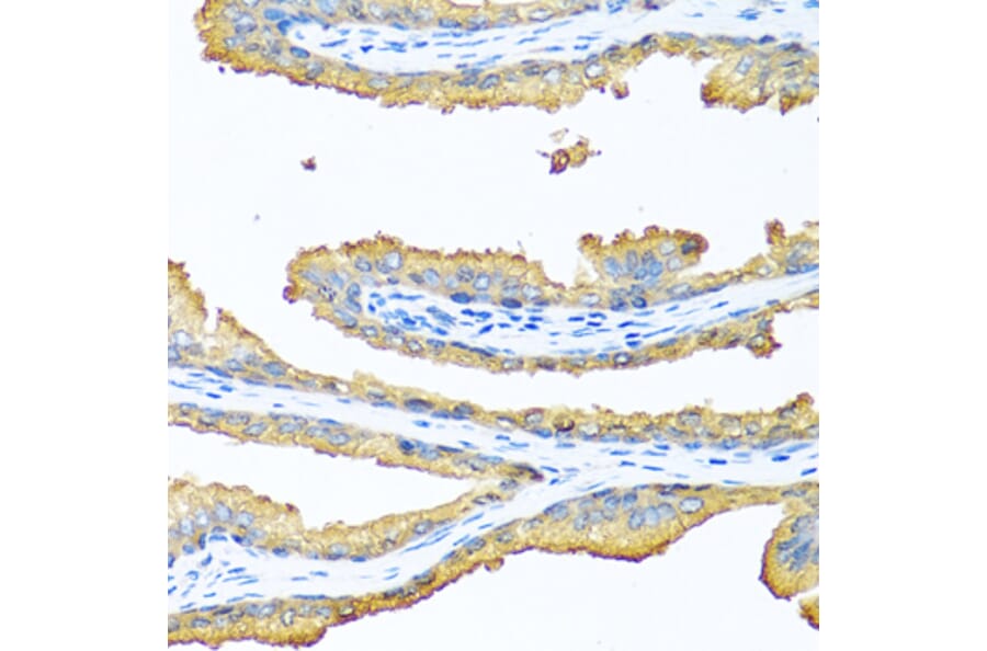 Immunohistochemistry - Anti-TAC1 Antibody (A13550) - Antibodies.com
