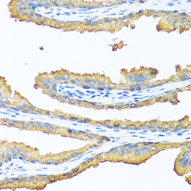 Immunohistochemistry - Anti-TAC1 Antibody (A13550) - Antibodies.com