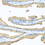 Immunohistochemistry - Anti-TAC1 Antibody (A13550) - Antibodies.com