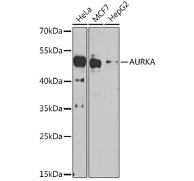 Western Blot - Anti-Aurora A Antibody (A91923) - Antibodies.com