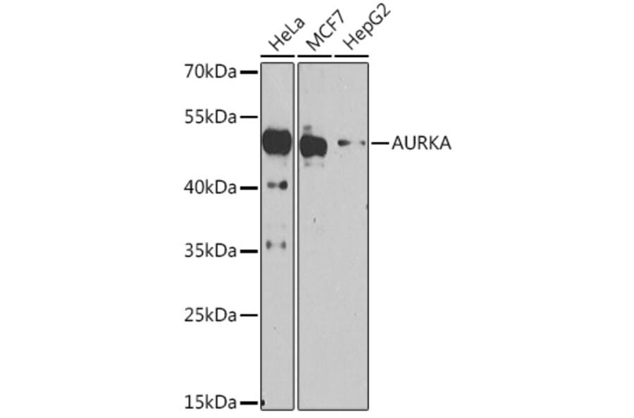 Western Blot - Anti-Aurora A Antibody (A91923) - Antibodies.com