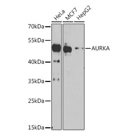 Western Blot - Anti-Aurora A Antibody (A91923) - Antibodies.com