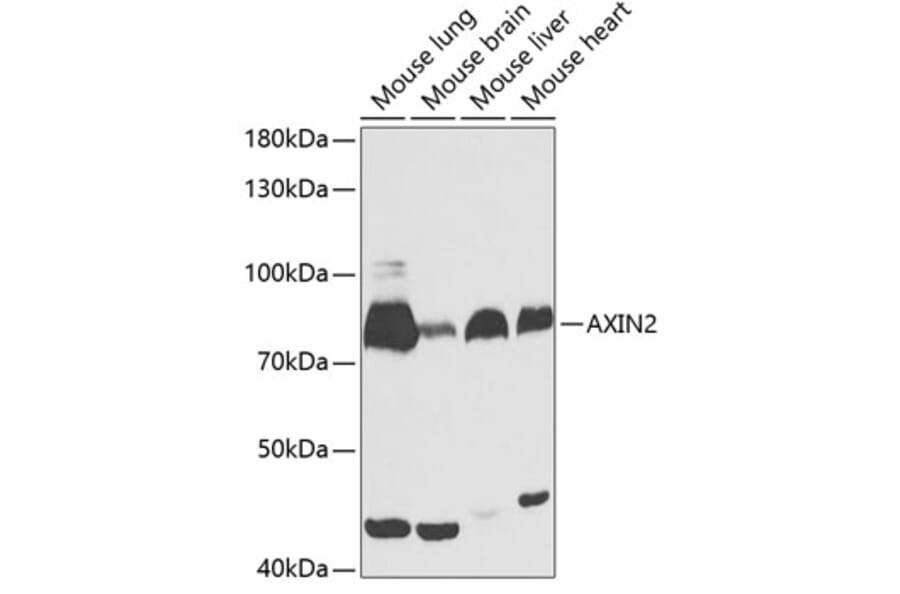 Western Blot - Anti-AXIN2 Antibody (A13373) - Antibodies.com