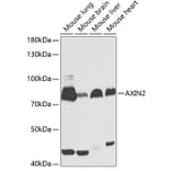 Western Blot - Anti-AXIN2 Antibody (A13373) - Antibodies.com