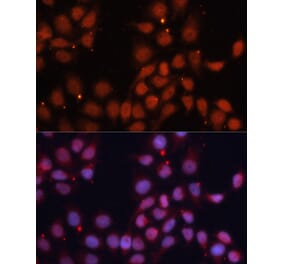 Immunofluorescence - Anti-CDK11B Antibody (A91925) - Antibodies.com