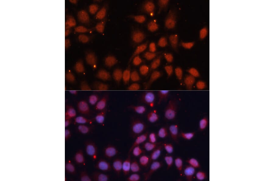 Immunofluorescence - Anti-CDK11B Antibody (A91925) - Antibodies.com
