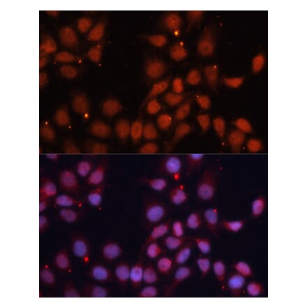 Immunofluorescence - Anti-CDK11B Antibody (A91925) - Antibodies.com