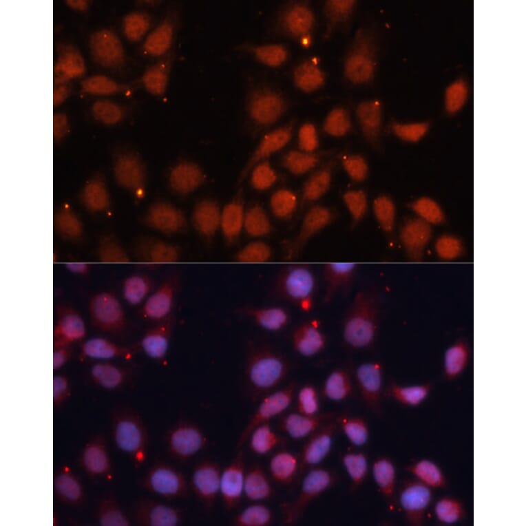 Immunofluorescence - Anti-CDK11B Antibody (A91925) - Antibodies.com