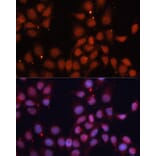 Immunofluorescence - Anti-CDK11B Antibody (A91925) - Antibodies.com