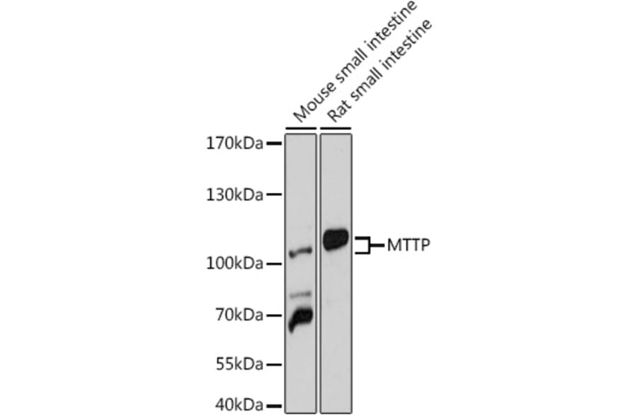 Western Blot - Anti-MTTP/MTP Antibody (A91927) - Antibodies.com