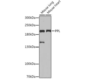 Western Blot - Anti-Periplakin Antibody (A91928) - Antibodies.com