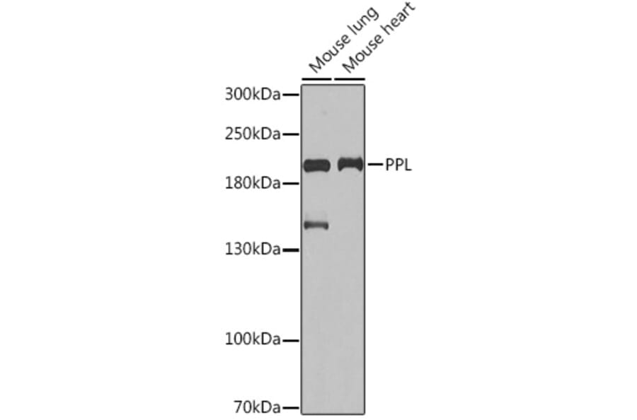 Western Blot - Anti-Periplakin Antibody (A91928) - Antibodies.com