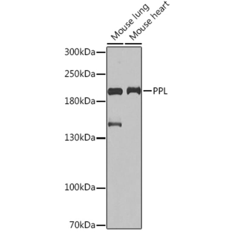 Western Blot - Anti-Periplakin Antibody (A91928) - Antibodies.com