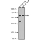 Western Blot - Anti-Periplakin Antibody (A91928) - Antibodies.com