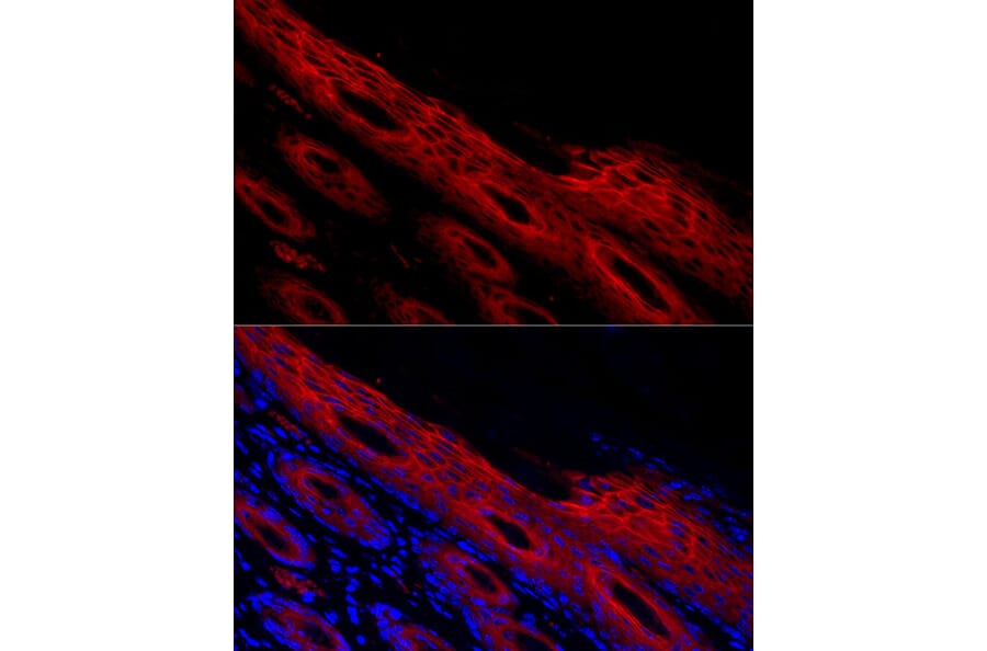 Immunofluorescence - Anti-Periplakin Antibody (A91928) - Antibodies.com