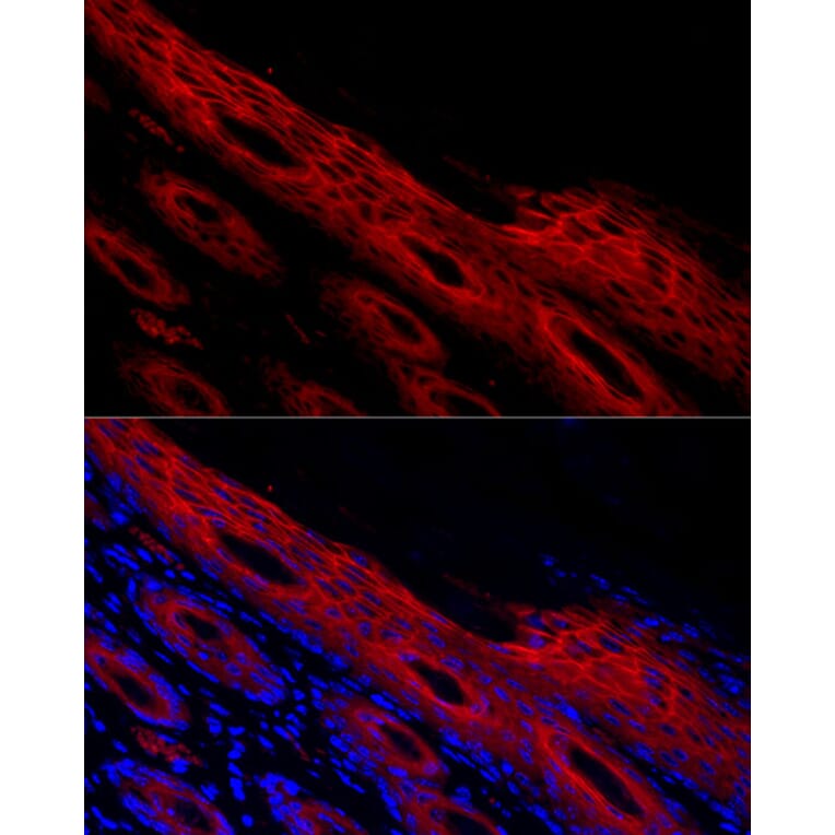 Immunofluorescence - Anti-Periplakin Antibody (A91928) - Antibodies.com