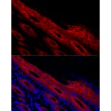 Immunofluorescence - Anti-Periplakin Antibody (A91928) - Antibodies.com