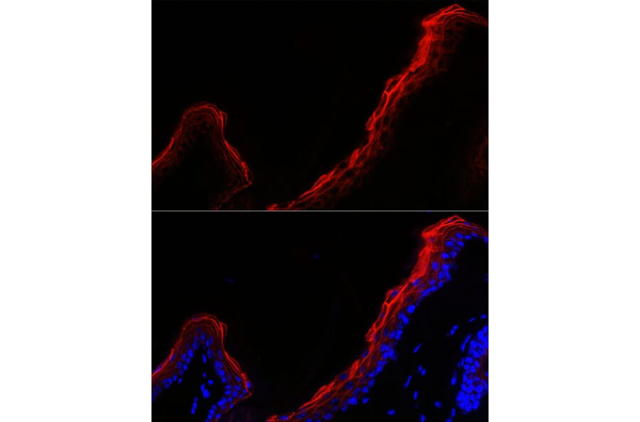 Immunofluorescence - Anti-Periplakin Antibody (A91928) - Antibodies.com
