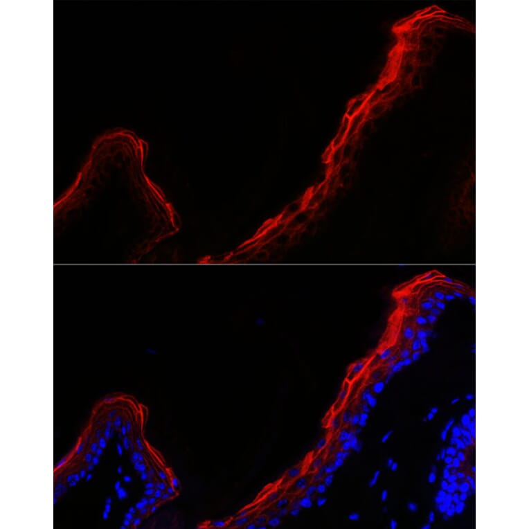 Immunofluorescence - Anti-Periplakin Antibody (A91928) - Antibodies.com