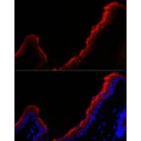 Immunofluorescence - Anti-Periplakin Antibody (A91928) - Antibodies.com