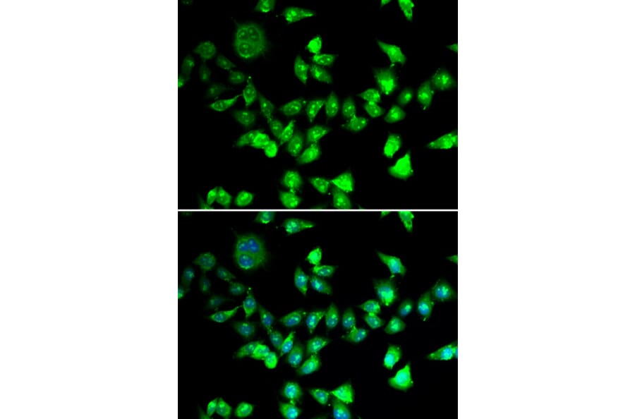 Immunofluorescence - Anti-SMC1A Antibody (A2240) - Antibodies.com